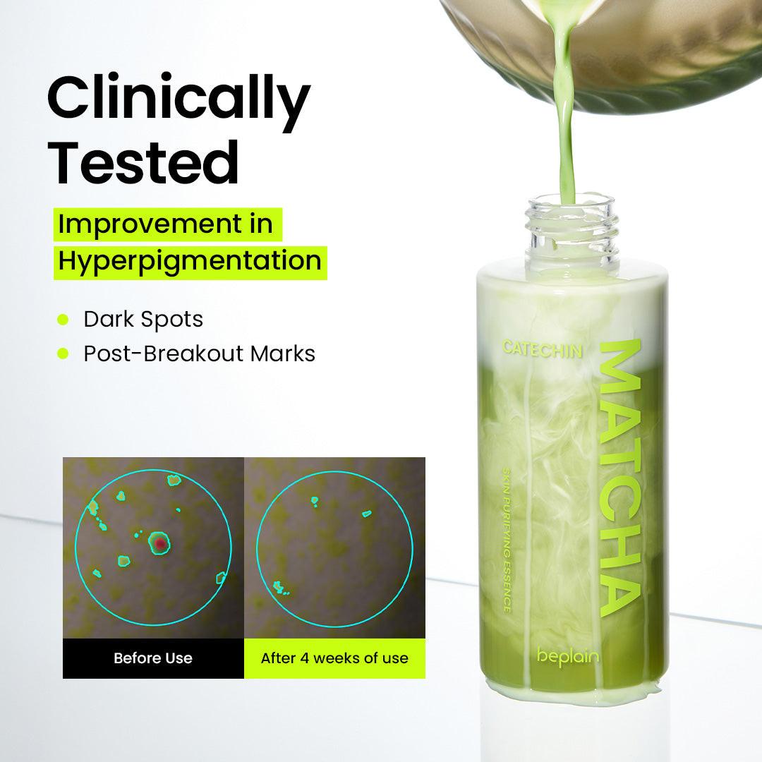 Beplain Matcha Catechin Essence - lightweight fast-absorbing essence for hyperpigmentation and uneven skin tone