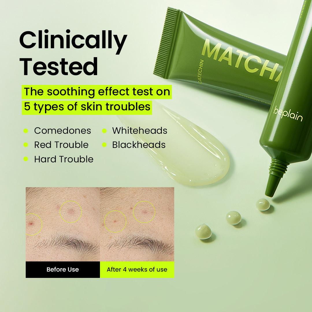 Beplain Matcha Catechin Intensive Care Cream - fragrance-light gentle K-beauty cream for sensitive and acne-prone skin